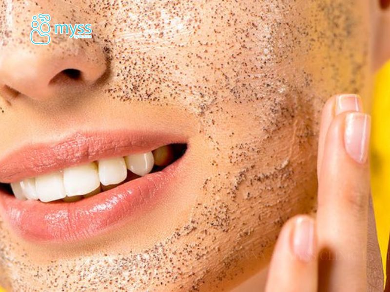 Cách trị mụn cám tại nhà