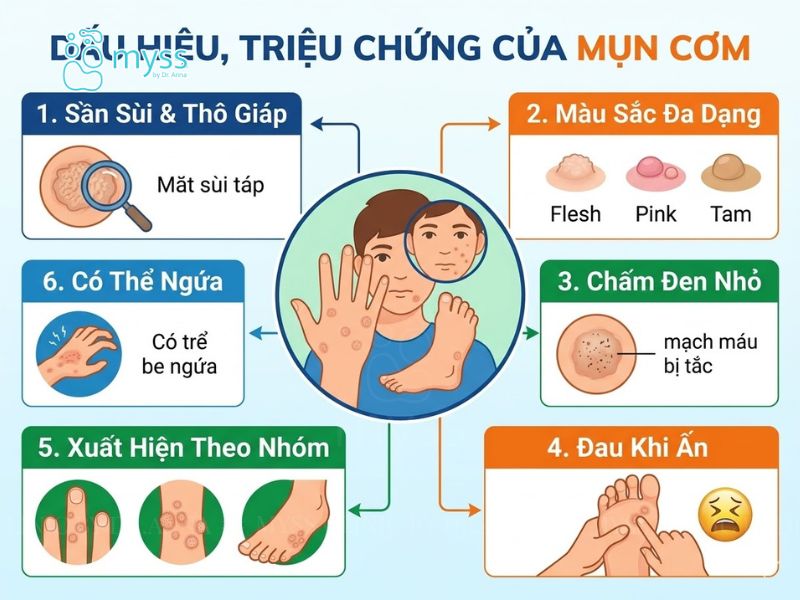 Dấu hiệu, triệu chứng của mụn cơm