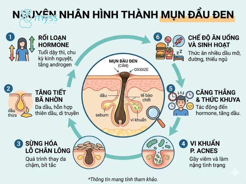 Nguyên nhân hình thành mụn đầu đen