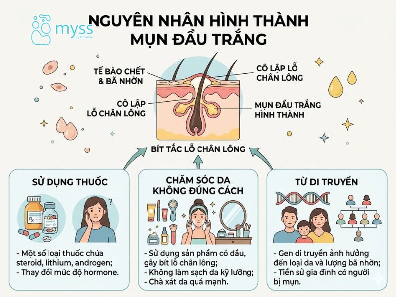 Nguyên nhân hình thành mụn đầu trắng
