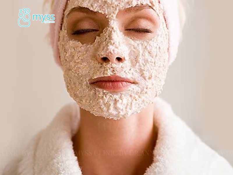 Trị mụn trứng cá mức độ nhẹ