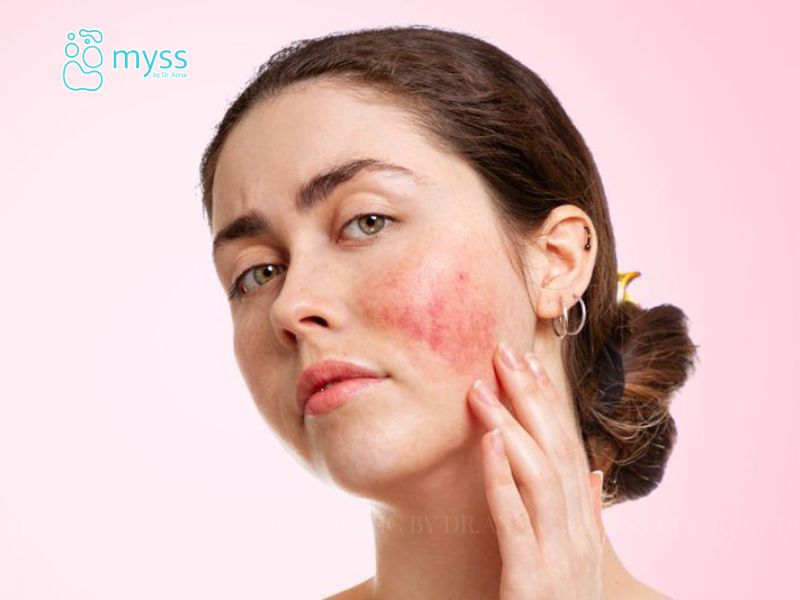 Tại sao da mặt bị dị ứng nổi sần ngứa? Cách điều trị hiệu quả