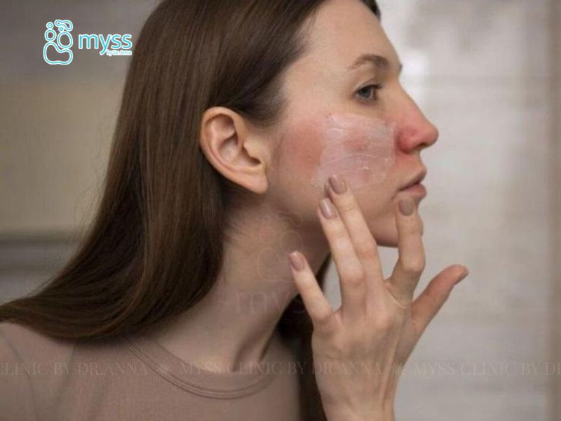 Da mặt bị khô bong tróc phải làm sao?