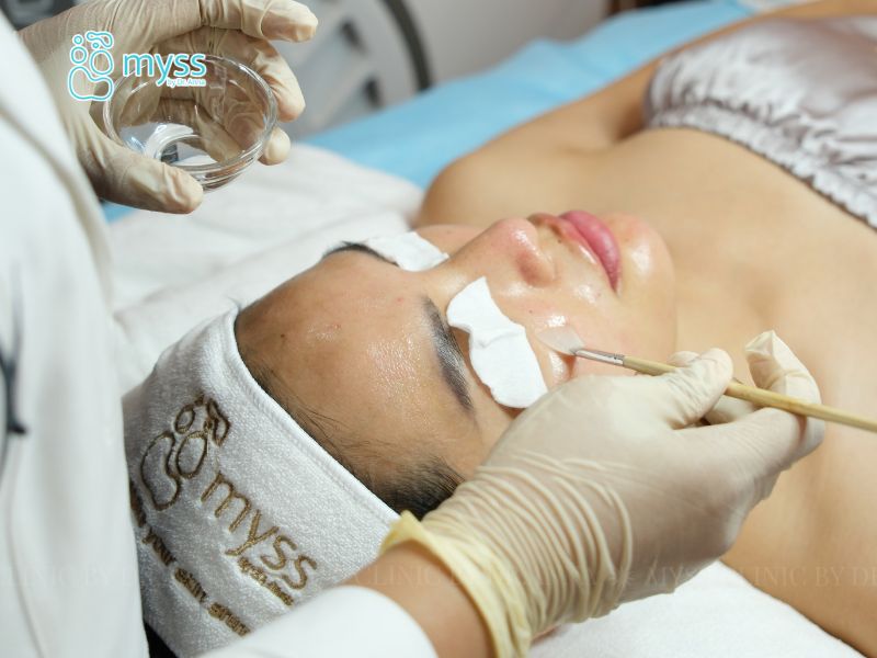 Ưu và nhược điểm của phương pháp peel da