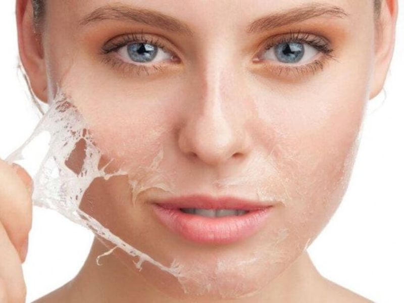Giải đáp: Có nên peel da không? Peel da có tốt không?