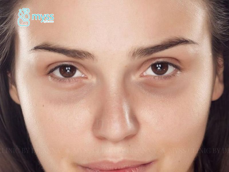 Vì sao da không đều màu? Có thể cải thiện được không?