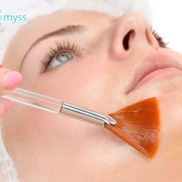 Liệu trình peel da bao nhiêu tiền? Cần lưu ý những gì?