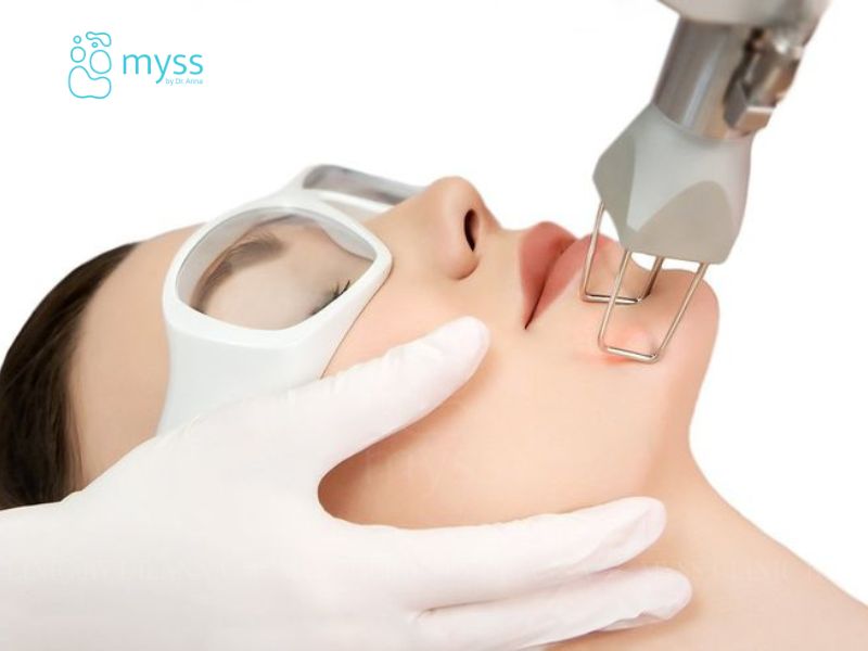 Các phương pháp điều trị mụn thịt phổ biến hiện nay