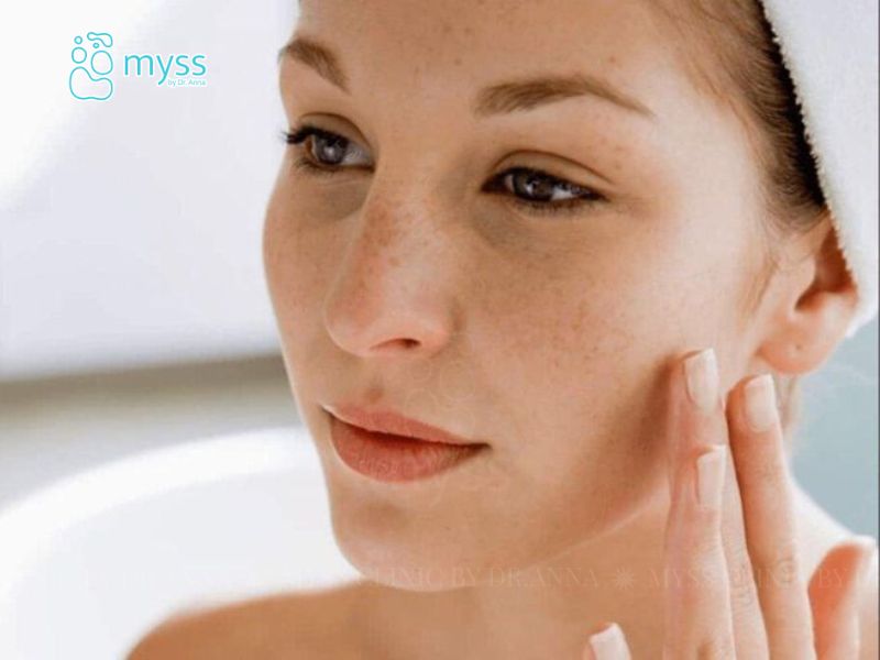 Nám da là gì? Dấu hiệu, nguyên nhân và cách khắc phục