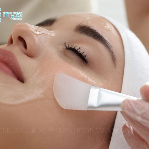 Peel da bao lâu thì rửa mặt? Cách chăm sóc sau khi peel da