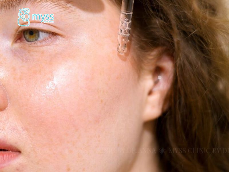Các yếu tố quyết định hiệu quả peel da trị nám