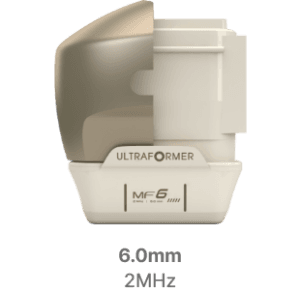 ĐẦU HIFU ULTRAFORMER III 6mm 2MHz