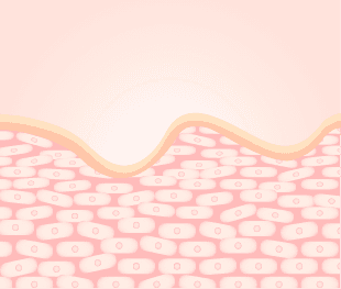 Bước 1: Collagen suy giảm theo thời gian