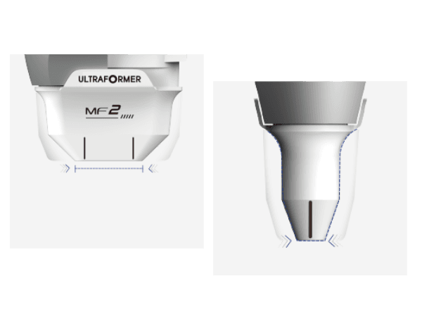 HIFU ULTRAFORMER III 4