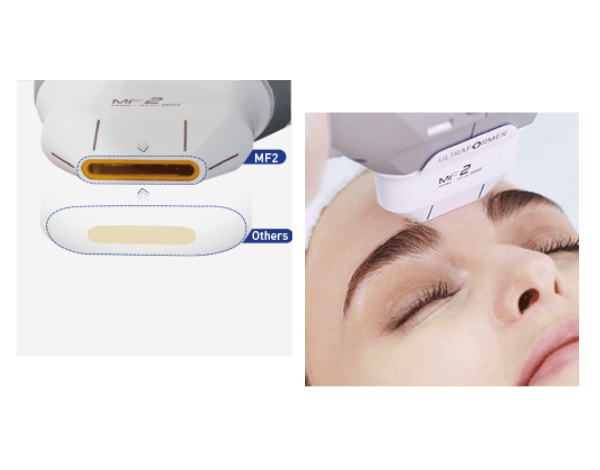 HIFU ULTRAFORMER III 5