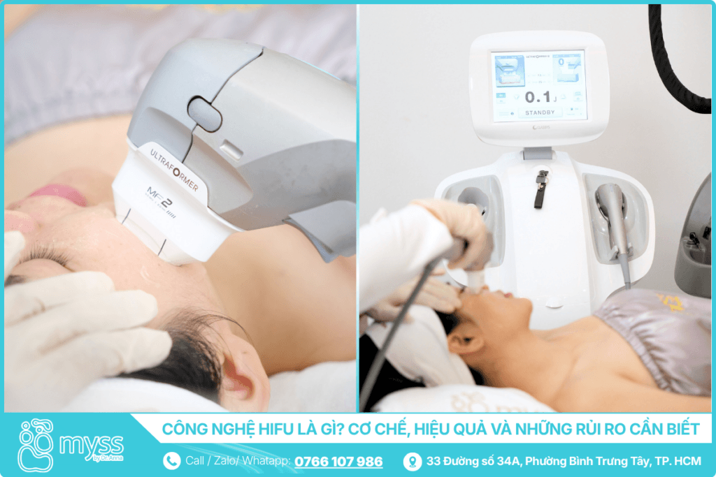 Công nghệ HIFU là gì - Cơ chế, hiệu quả và những rủi ro cần biết