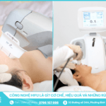 Công nghệ HIFU là gì - Cơ chế, hiệu quả và những rủi ro cần biết