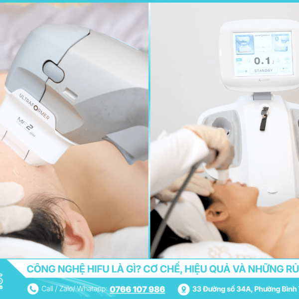 Công nghệ HIFU là gì - Cơ chế, hiệu quả và những rủi ro cần biết