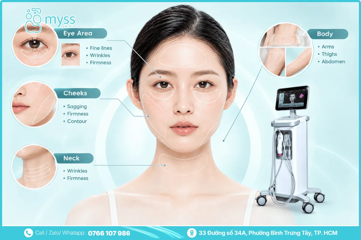 Applications of Thermage for the face and body
