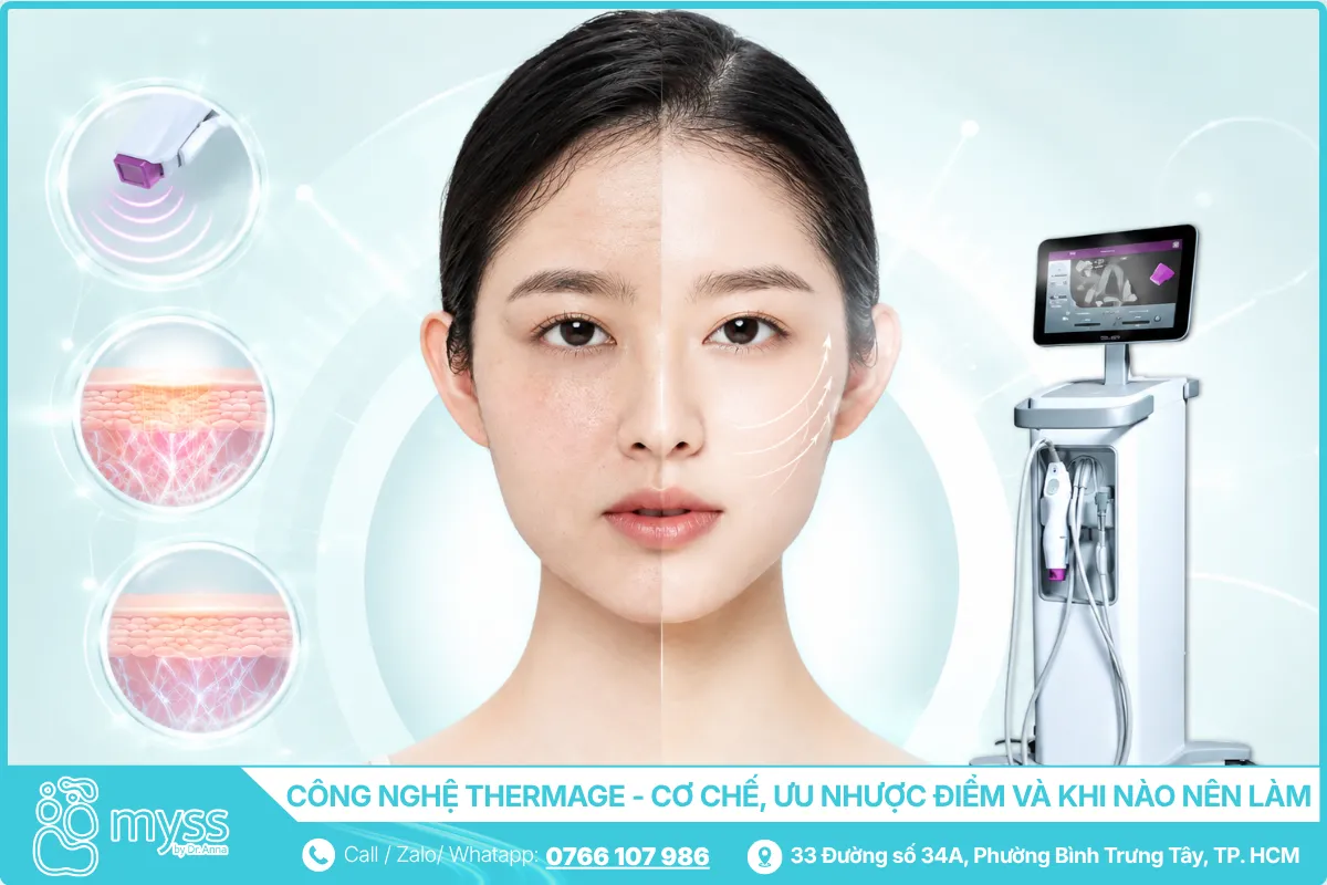 Công nghệ Thermage là gì - Cơ chế, ưu nhược điểm và khi nào nên làm