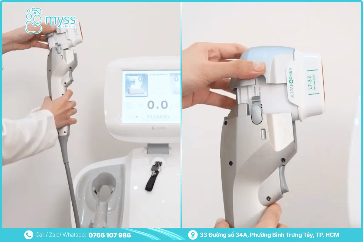 Is HIFU facelifting effective