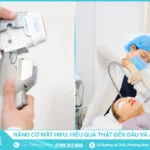 Nâng cơ mặt HIFU - Hiệu quả thật đến đâu và ai phù hợp