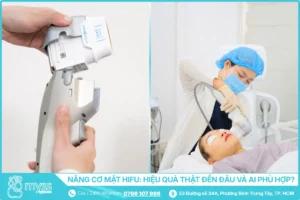 Nâng cơ mặt HIFU - Hiệu quả thật đến đâu và ai phù hợp