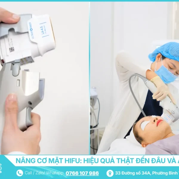 Nâng cơ mặt HIFU - Hiệu quả thật đến đâu và ai phù hợp