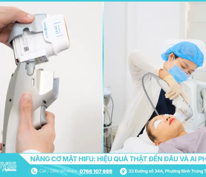 Nâng cơ mặt HIFU - Hiệu quả thật đến đâu và ai phù hợp