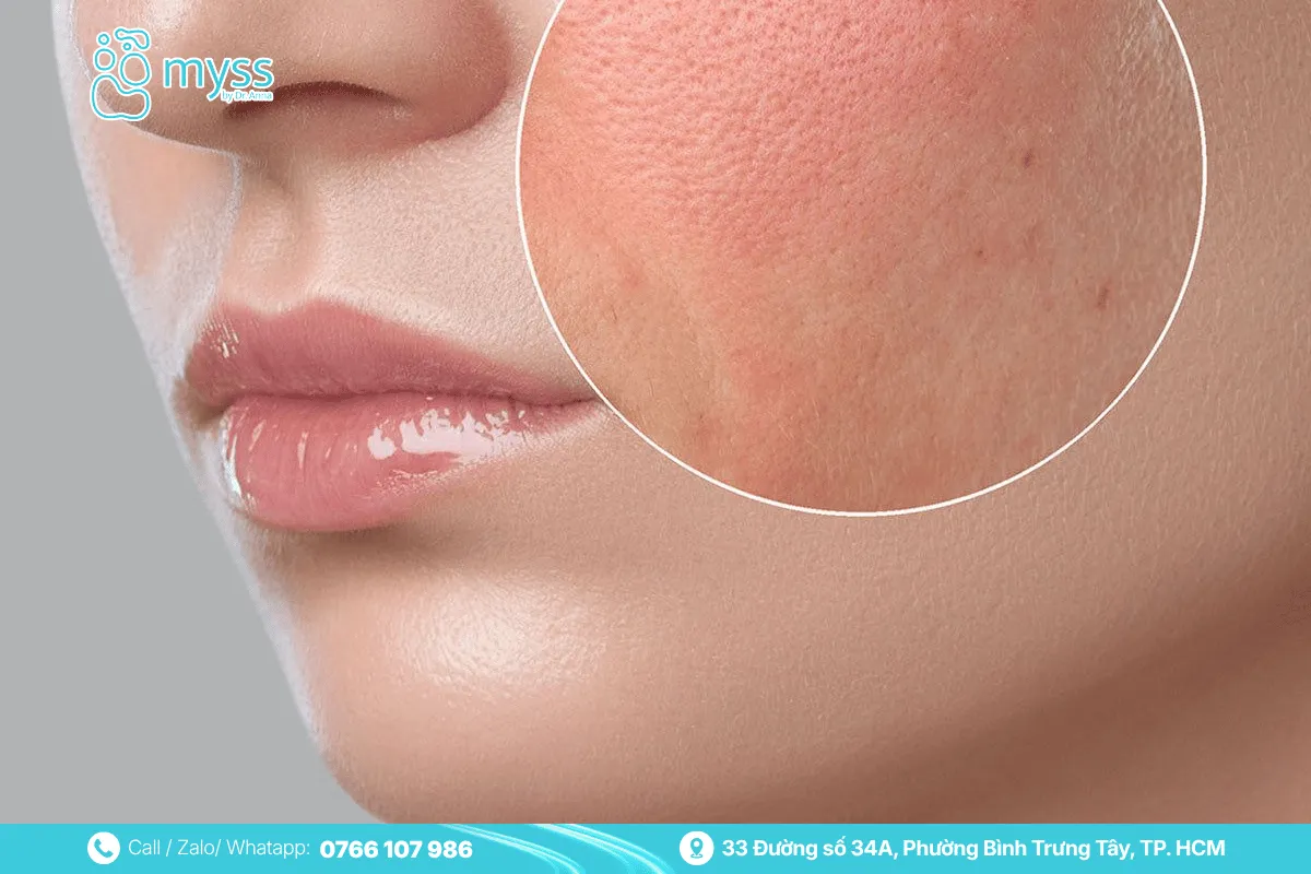 Possible side effects of Karisma