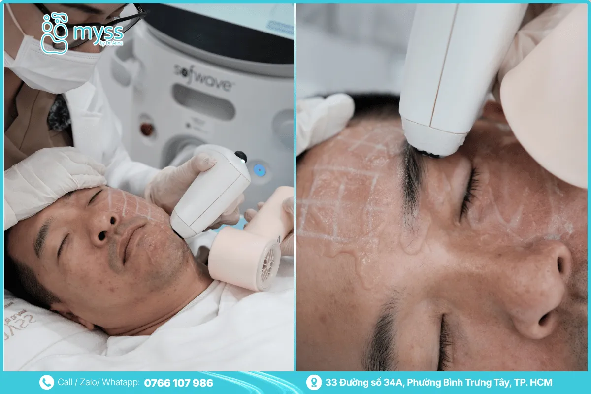Sofwave suits many skin-aging conditions