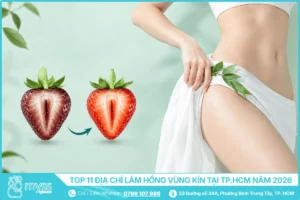 Top 11 Địa Chỉ Làm Hồng Vùng Kín Tại TP.HCM Năm 2026