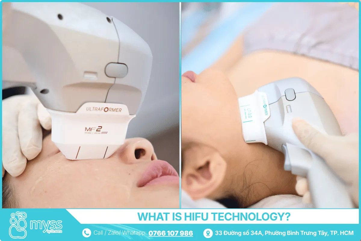 What Is HIFU Technology? Mechanism, Effectiveness, and Risks You Should Know