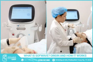 What Is Sofwave? Origin and How It Works